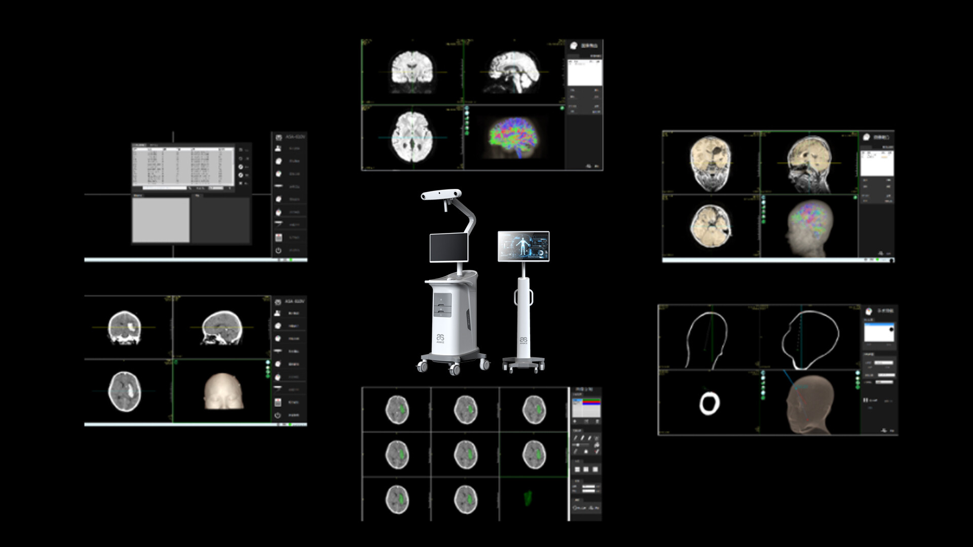 手术导航仪外观设计-安科手术导航仪外观设计